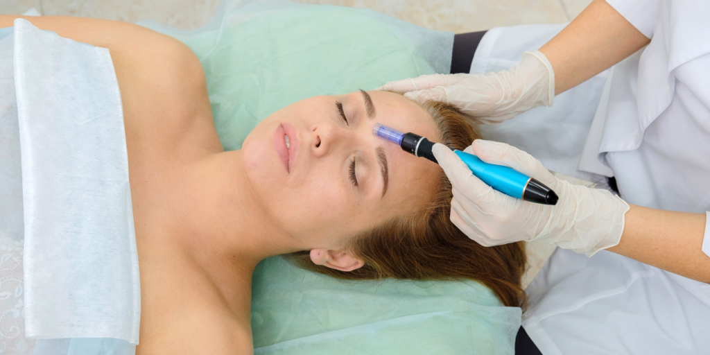 Microneedling